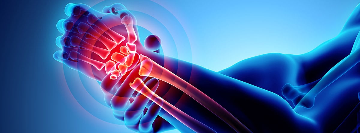 Encuentra a tu traumatólogo para lesiones de muñeca en Almería