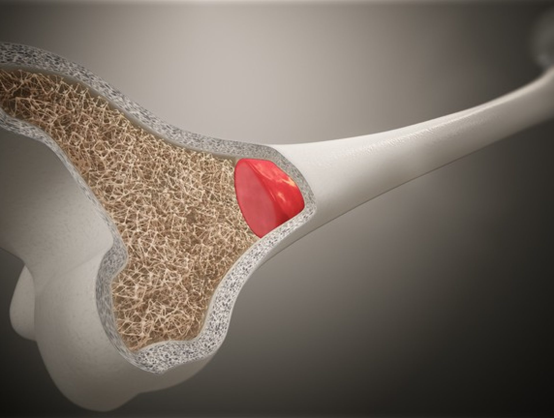 Encuentra a tu traumatólogo para lesiones de hombro en Almería